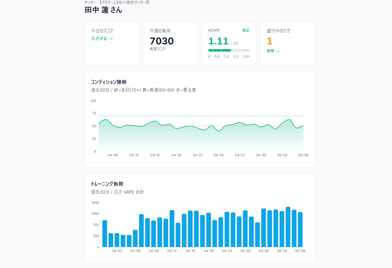 ACWR自動計算